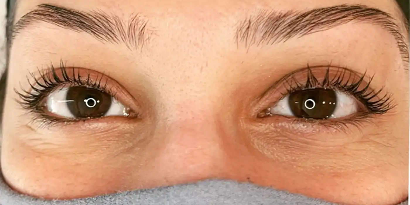 Eyelash Lift After